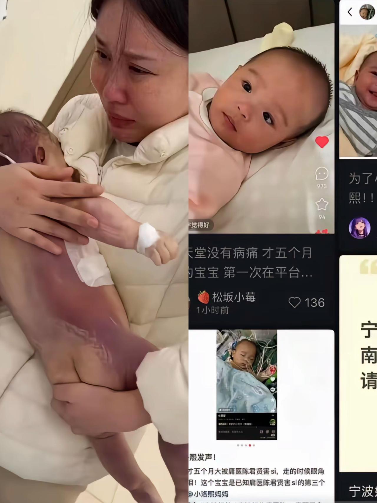 看到妈妈抱着发紫的宝宝直接给我干泪崩了太太太难受了！五个月大的宝宝做微