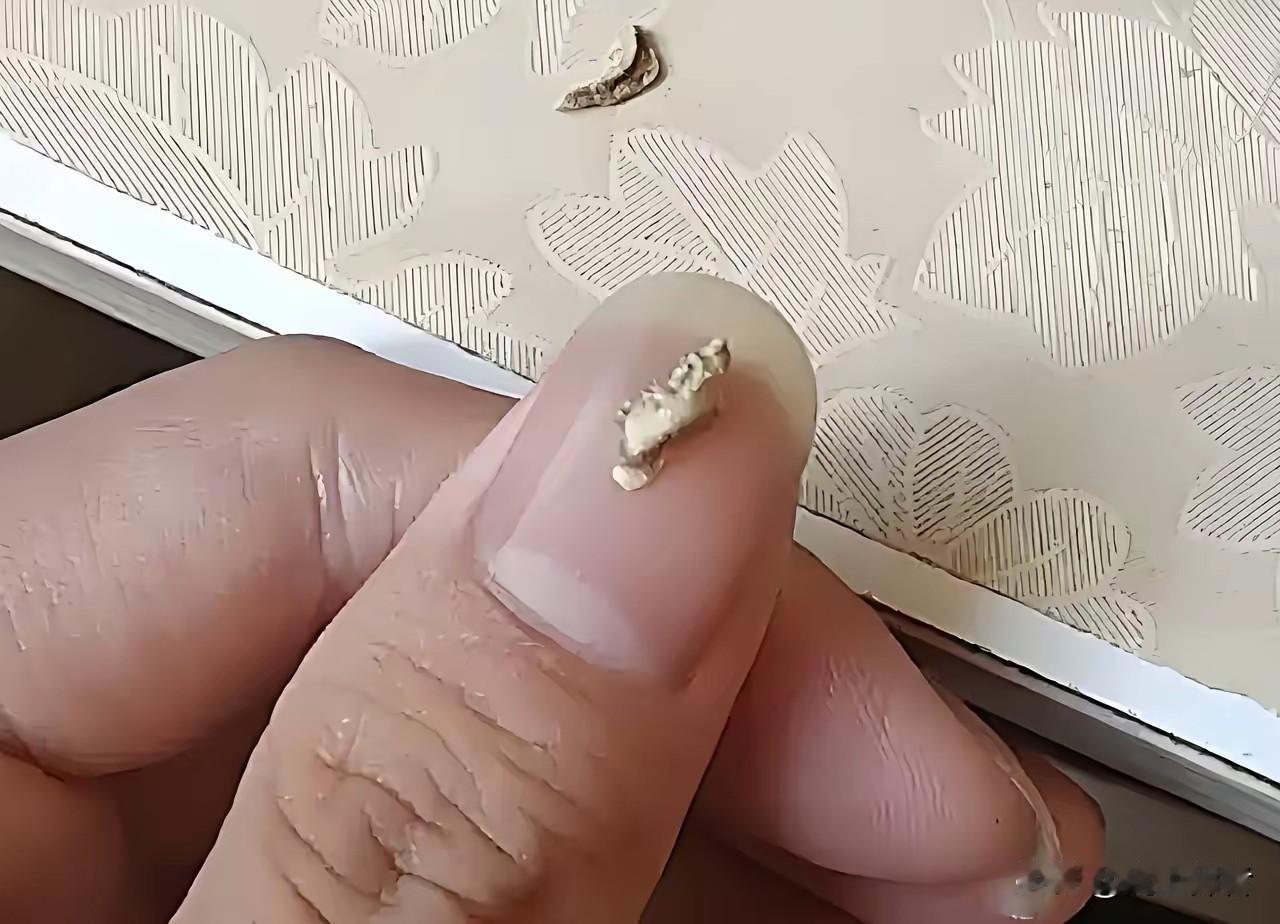 前天牙结石掉了一块，这两天总感觉牙齿特别不舒服，总忍不住用舌头舔，舔完还是不舒服