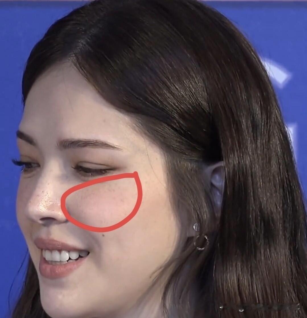 尽管脸上有很多斑点，但一点也不影响到她的气质，是女明星里比较真实的一个，大大方方