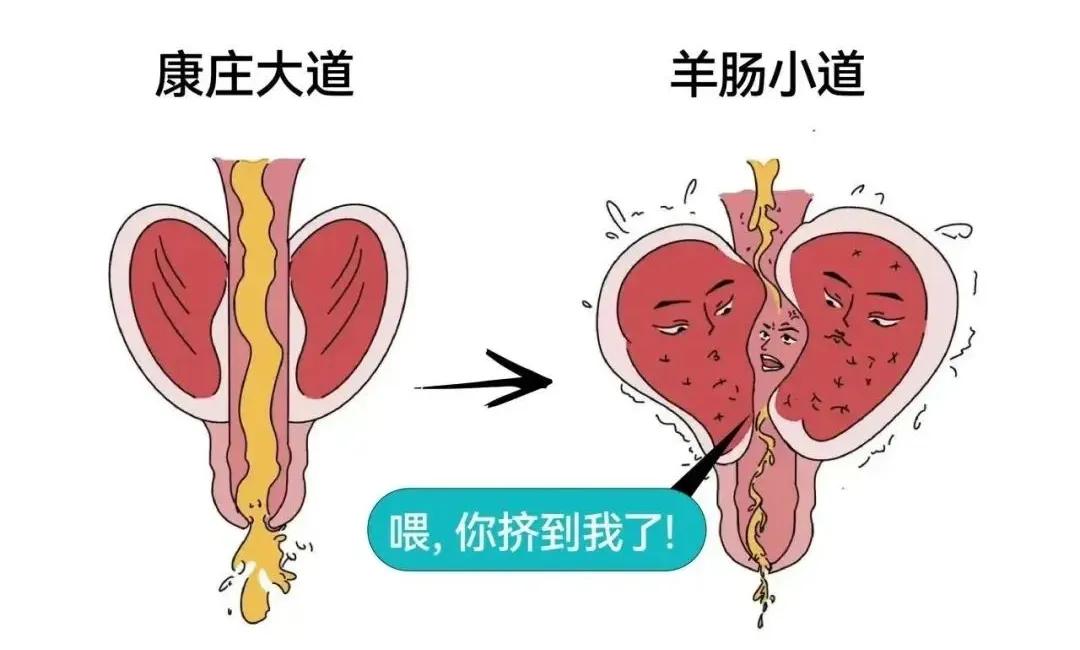 不少中老年男性查出前列腺问题，医生会建议做PET‑CT。很多人疑惑：这项检查贵，