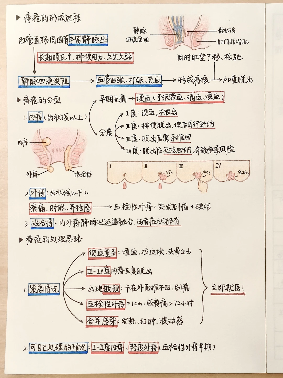 医学生笔记｜痔疮的几种类型及处理
