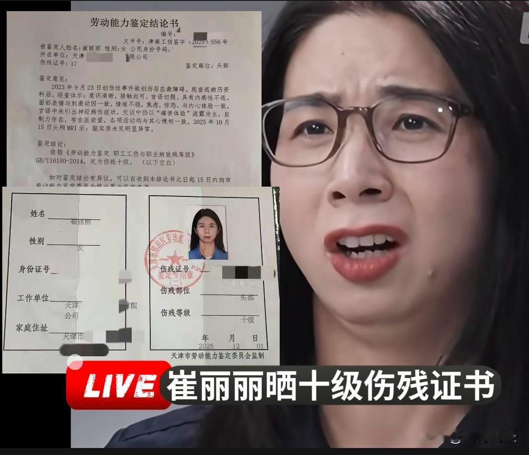 崔丽丽晒十级伤残证书伤残部位：头部伤残等级：十级简单来说，十级伤残是法律上