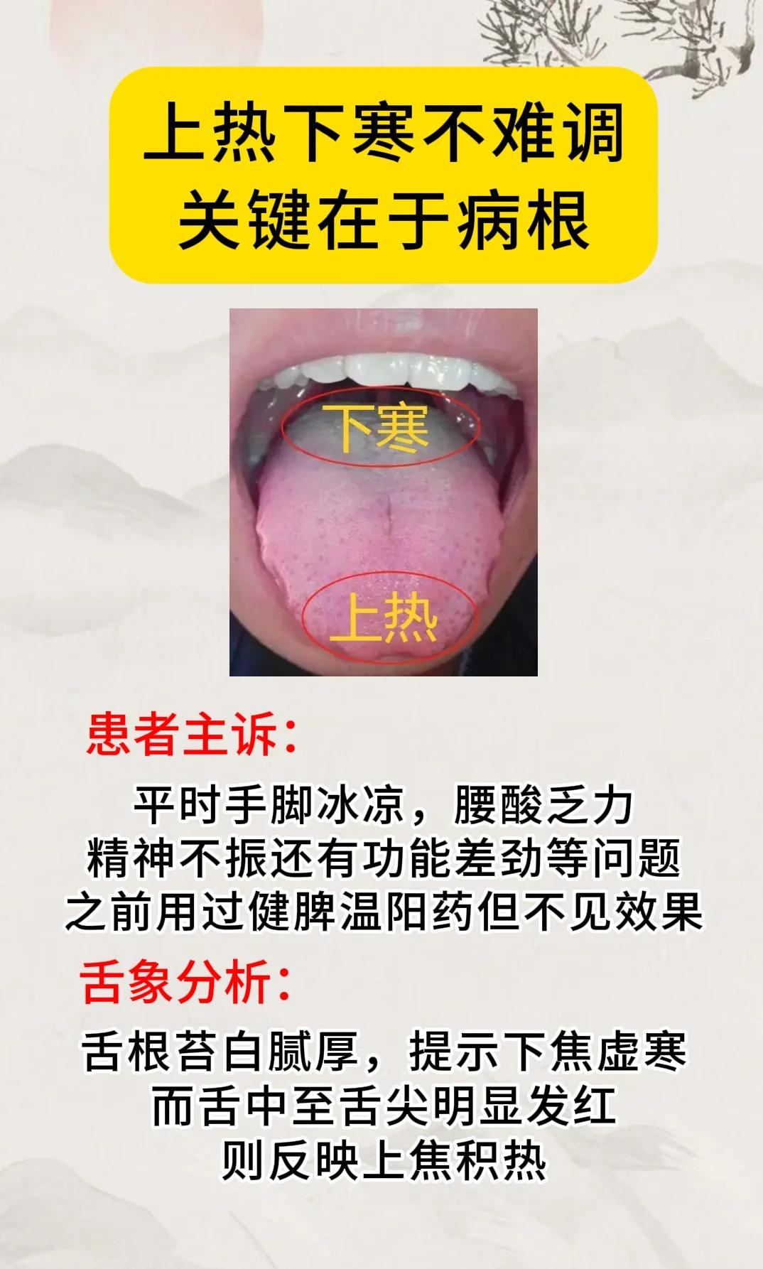 上热下寒不难调，关键在于病根！