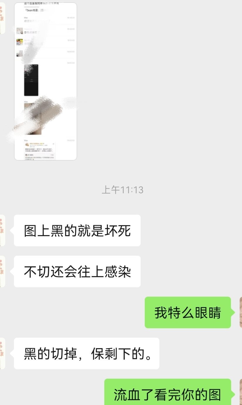 我的眼睛一直在被攻击​​​