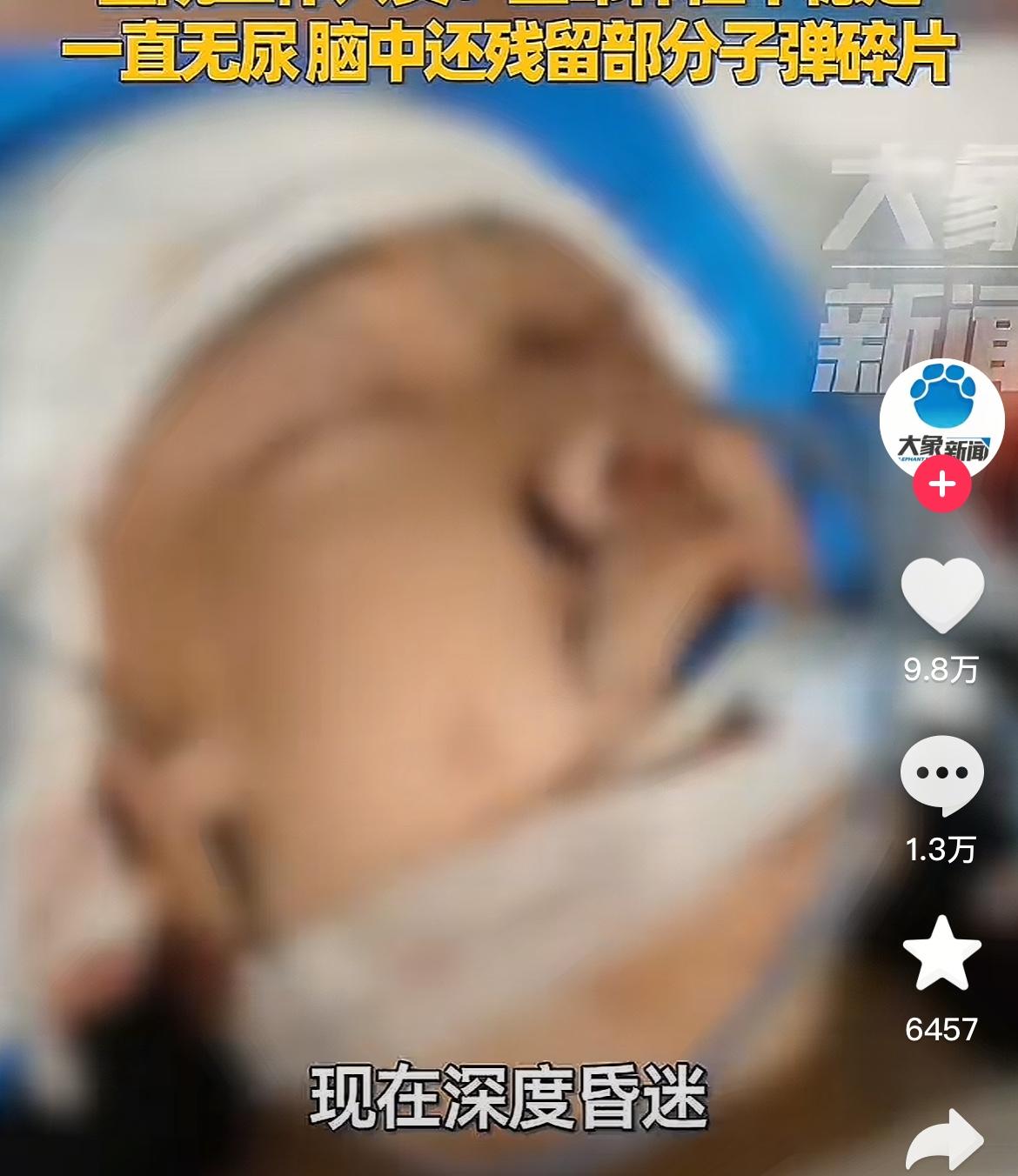 安徽亳州18岁小伙凌晨疑似被当猎物气枪爆头，送入ICU生命垂危，家属呼吁懂脑部枪