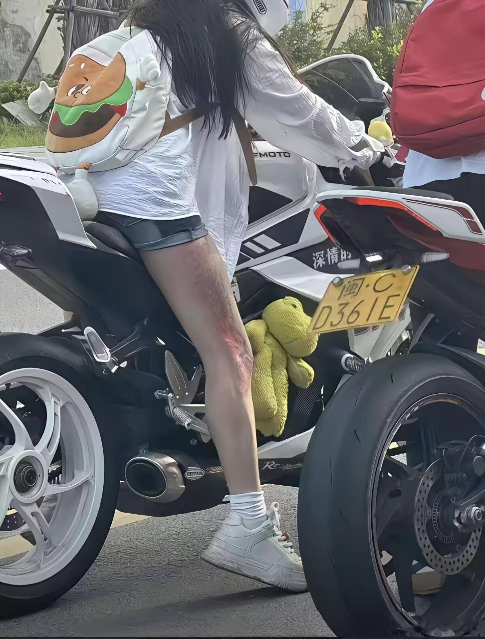 不管是开车还是骑车都慢点吧，这擦这么严重，哪个父母看了不心疼啊