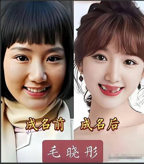 成名后颜值升级了，人还是那个人，成名后变好看了，这是为什么呢？年少有年少时的青涩美丽，成长有成长后的