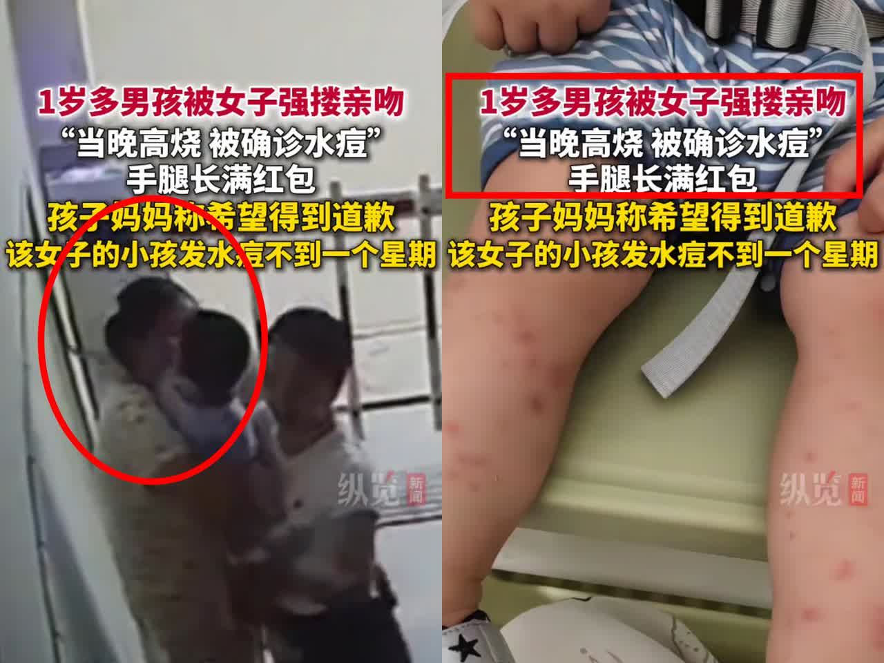 “缺德到这份上也是绝了！”湖南这女子，为了自己孩子能早康复，竟故意把水痘