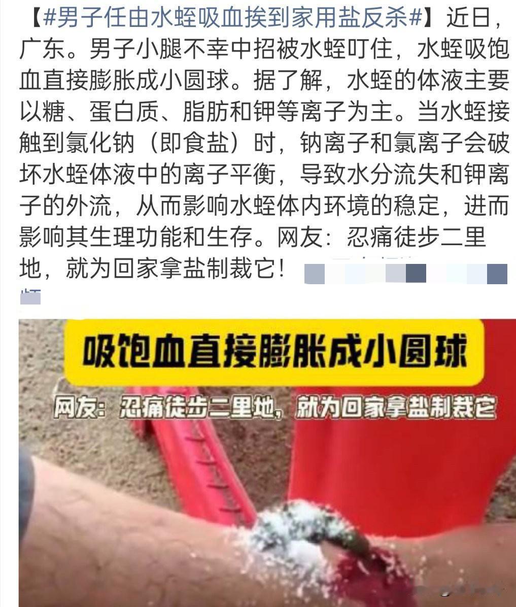 男子被水蛭叮咬后“忍痛复仇”引热议，专家：正确处理方式更安全有效近日，广东一