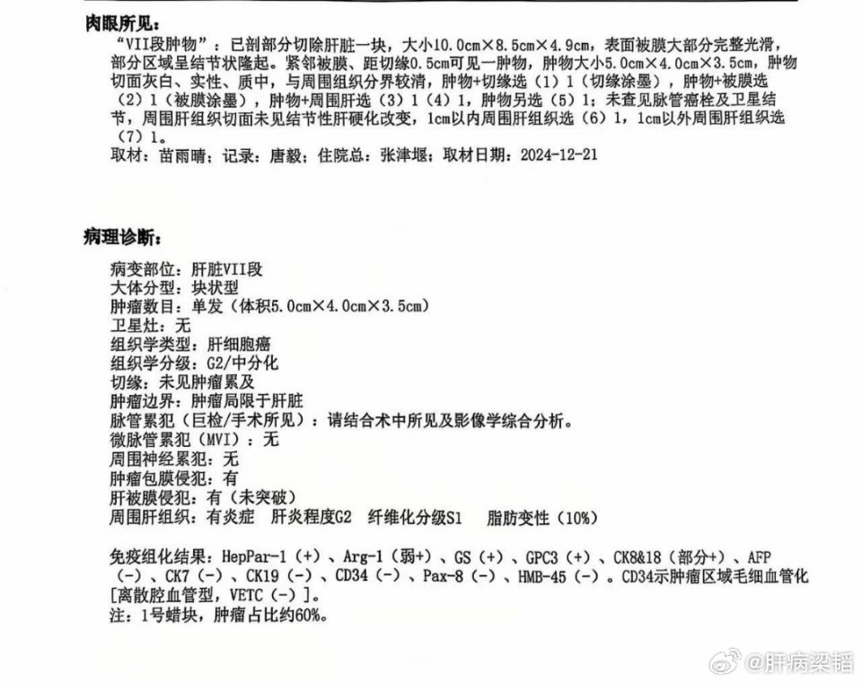 肝癌手术是否成功，除了远期随访观察，重点看当时切下来的病理情况，特别是切缘、脉管