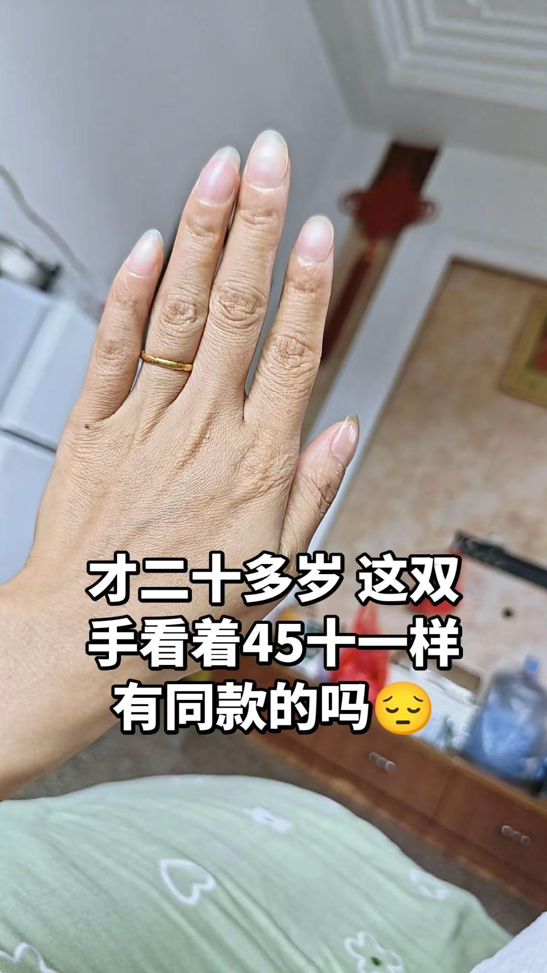 有没有像我一样的手看着显老看着就知道是双苦命的手粗糙的双手