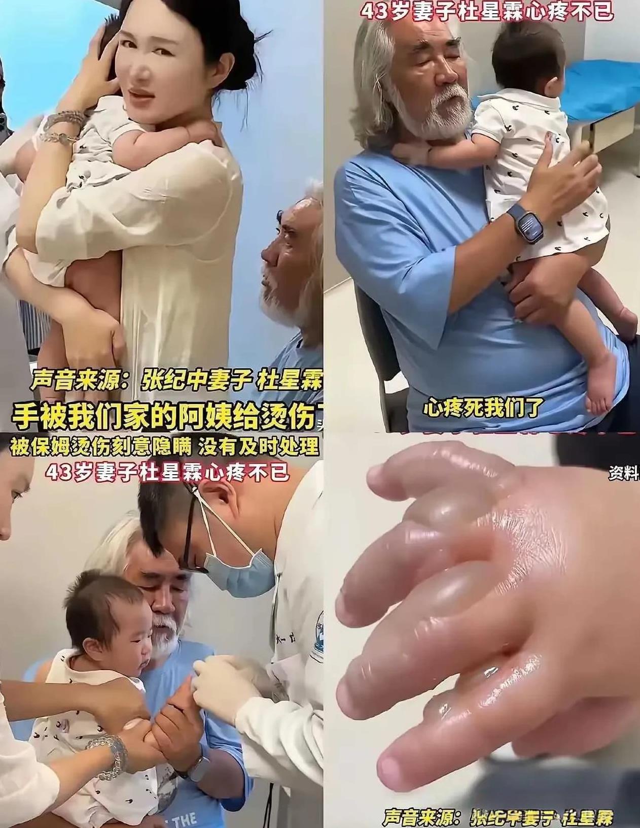 杜星霖这个富家太太，太失败啦！九个月孩子交给保姆看管，结果被烫伤保姆愣是不告知，