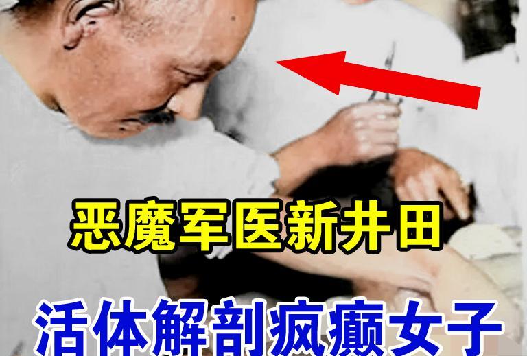 姑娘主动爬上木板搭建的解剖台，笑呵呵地脱下裤子，几个医助立刻按住她的手脚，一个军