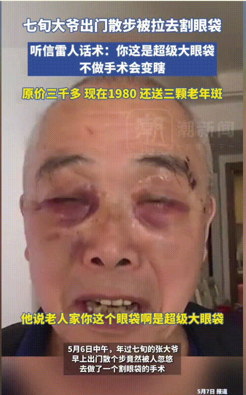 七旬大爷早上散步，遇到热情推销，说他眼袋巨大不做手术会瞎。大爷信以为真，被带