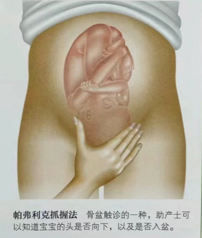 产科医生下手很重会不会伤害宝宝啊