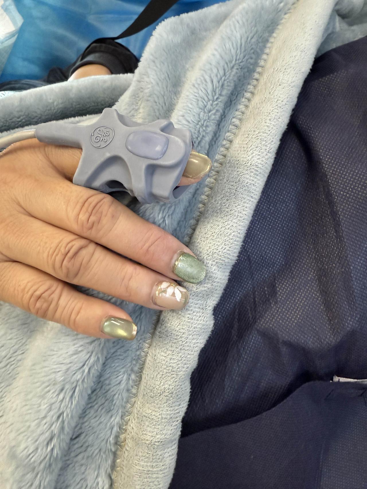 友情提醒：做麻醉胃肠镜不要涂非常厚的美甲。颜色越鲜艳，涂得越厚，它越容易影响麻