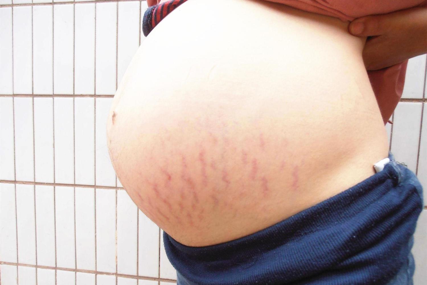 孕妈回娘家住了两天, 半路宝宝流产, 原因让婆婆怒甩一巴掌!