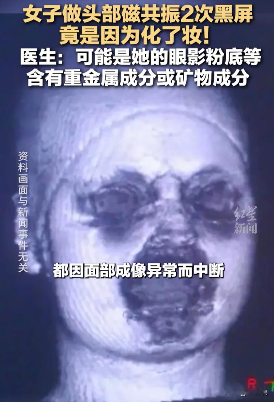 差点解释不清了！福建泉州，一女子头晕去医院检查，没想到，做核磁共振时先后两次出现