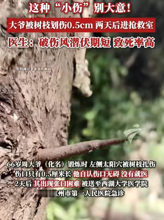 🌞“悲剧还是发生了！”7月17日报道，浙江，一大爷出门锻炼时，太阳穴被树枝