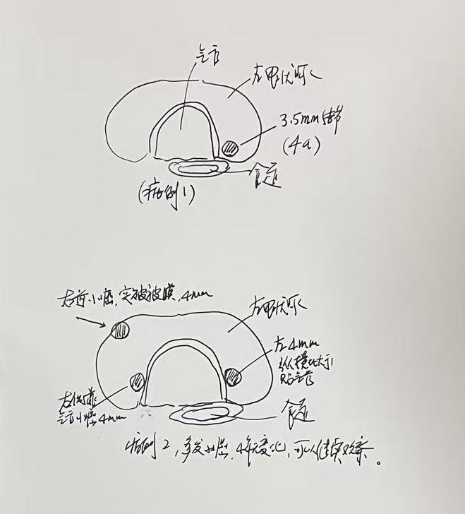 决策比手术本身更重要❗️一个病要不要开刀，如果需要开，怎么开，这些关于决策的基本