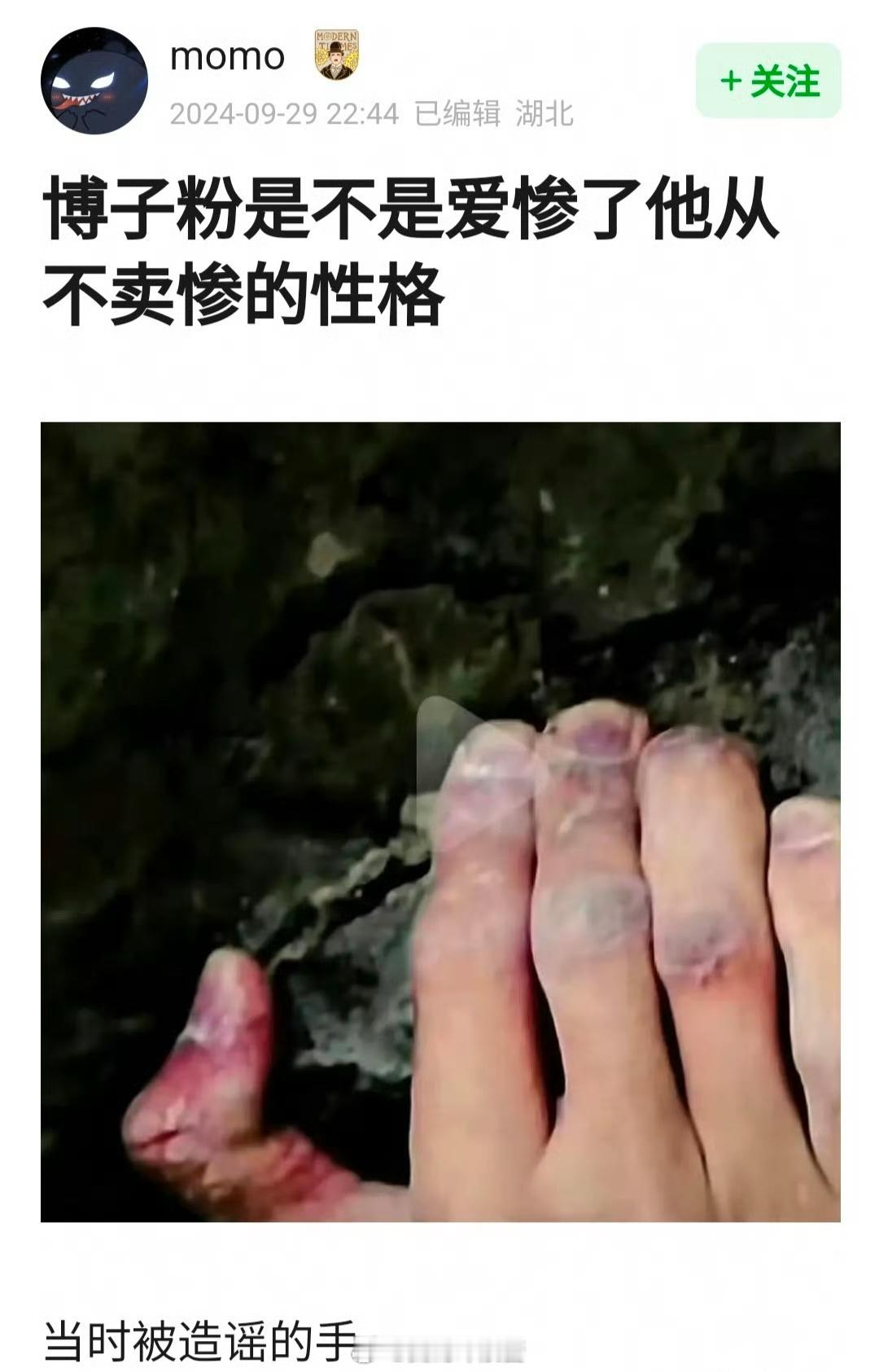 王一博粉是不是爱惨了他从不卖惨的性格[哭哭]​​​