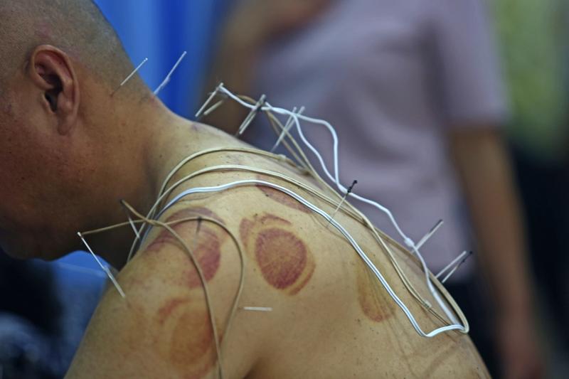 阳气不足，人会咋样？阳气不足，人可就遭老罪咯！从身体状况来说，阳气不足的人特别