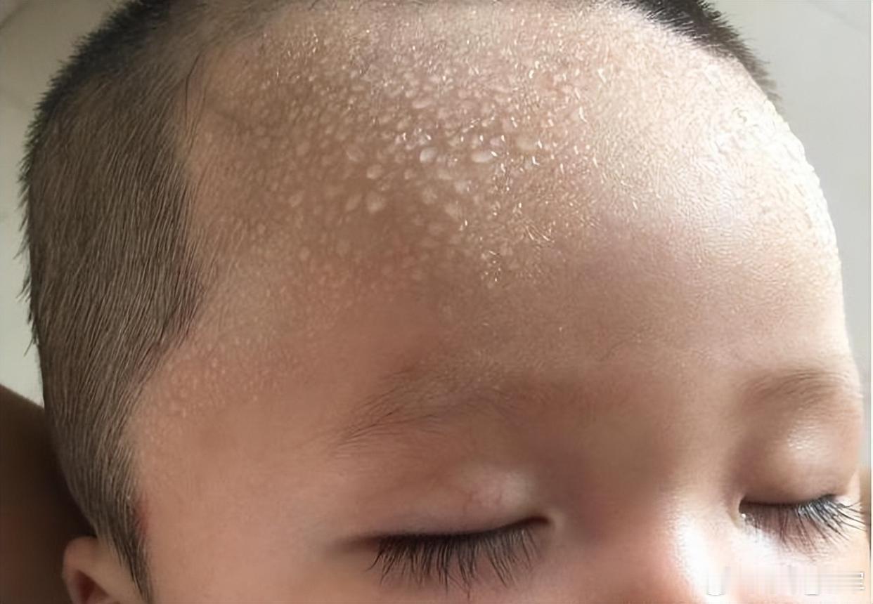 孩子一睡觉就出汗？多半是内热！中医教你一招，消积去热修护脾胃你家娃儿睡着后，会有