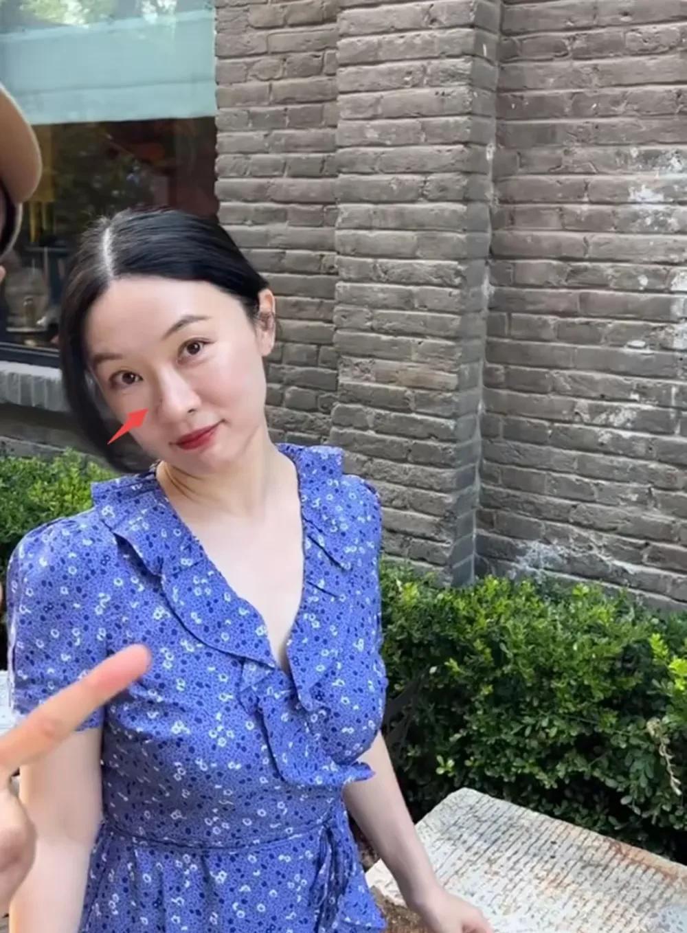 网友在北京偶遇霍思燕，霍思燕瘦了好多，穿着蓝色碎花裙，扎着低丸子头，素颜朝天看起