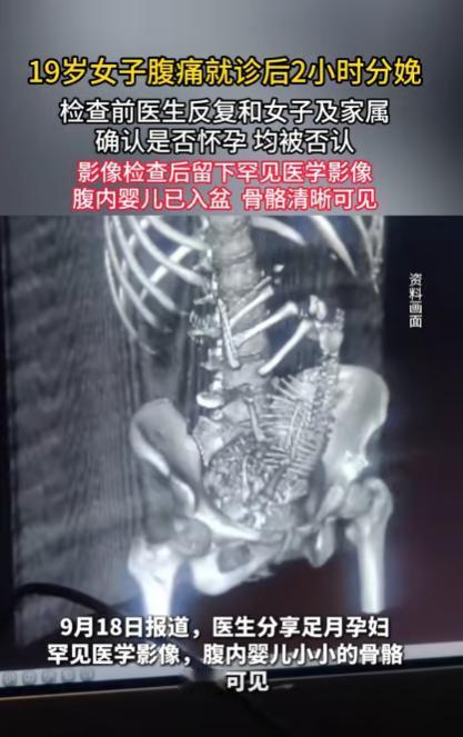 “离了个大谱！”2025年9月，一19岁女孩因为肚子疼到医院里就诊，期间医生反复