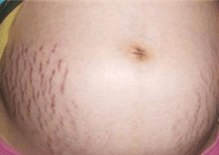 这4种方法可自测男女你相信吗?