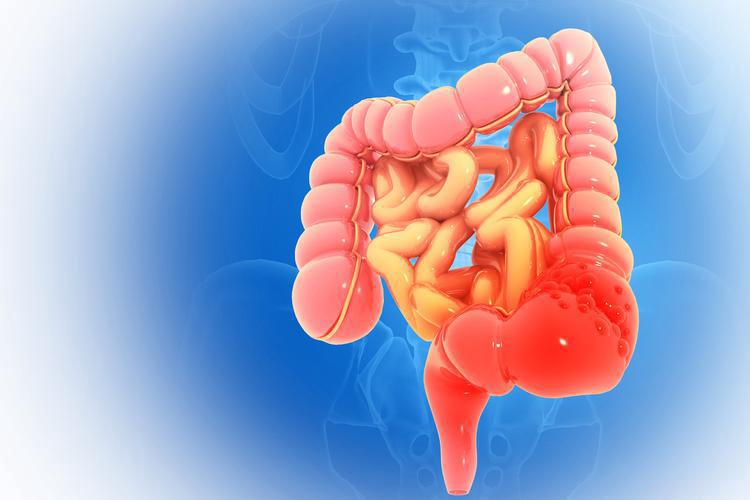 接诊时总会遇到直肠癌患者问能否吃红薯，有人说吃了促排便好，有人称会加重肠道负担，