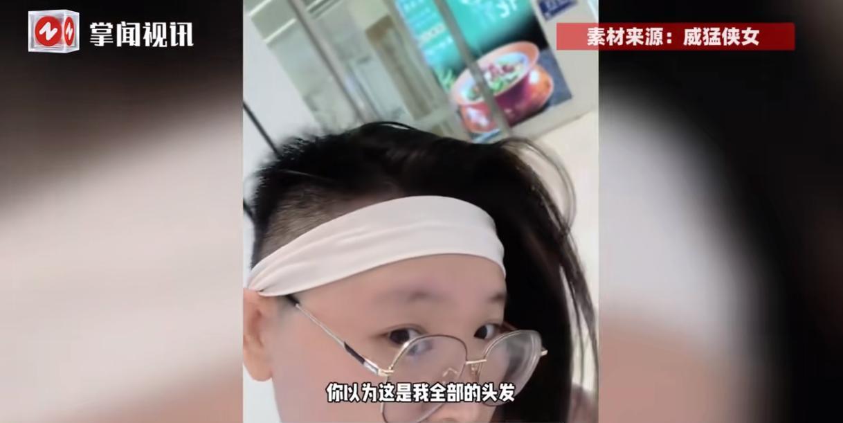 “活久见！”6月7日，北京，一女子头上的毛囊和普通人有很大的不同，平均一个毛囊里