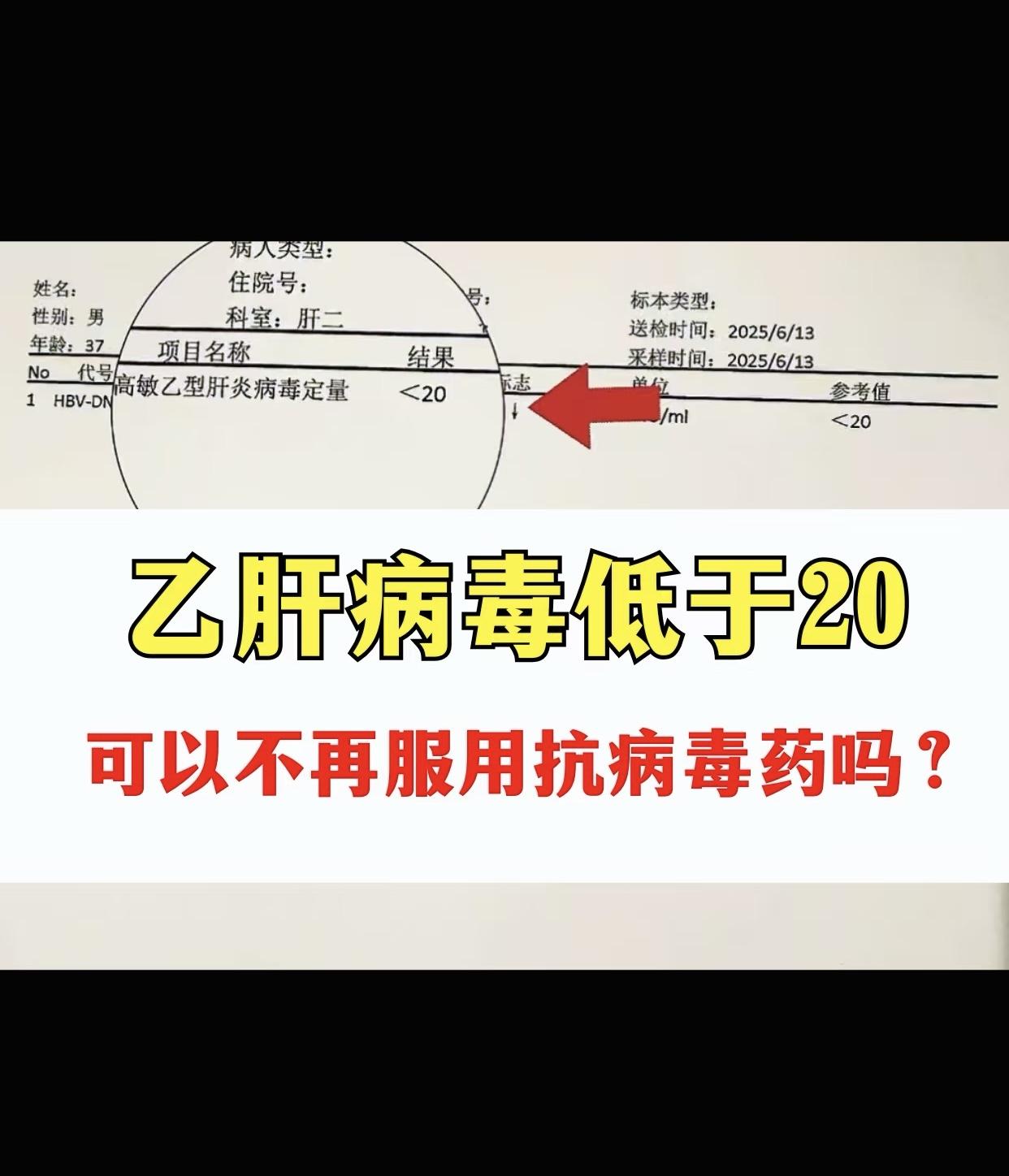 乙肝病毒低于20，可以不用服用抗病毒药吗？  天天都吃药，真的坚持不住...
