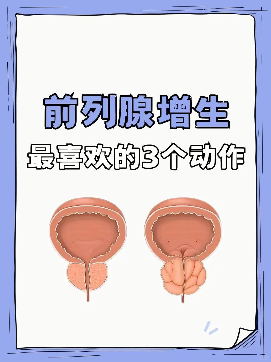 前列腺最喜欢的3个动作，赶紧动起来吧！