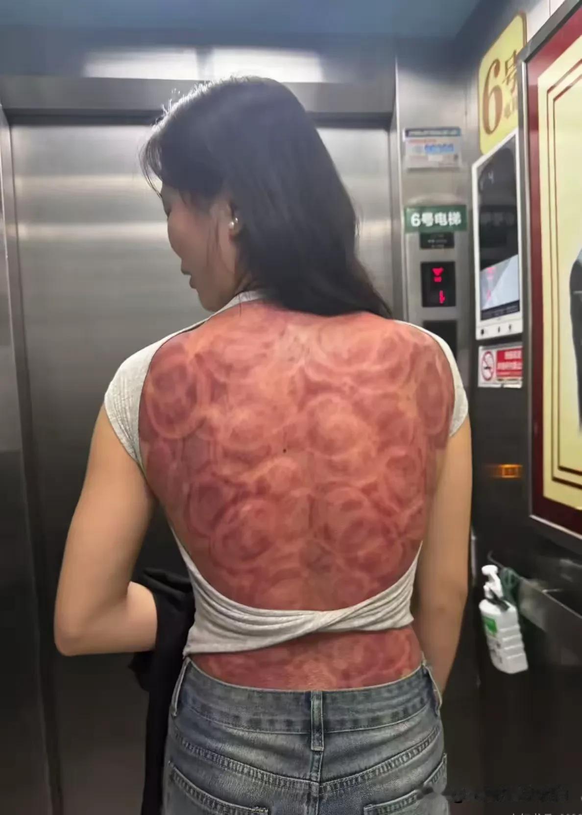这是什么皮肤病，还有得治吗？