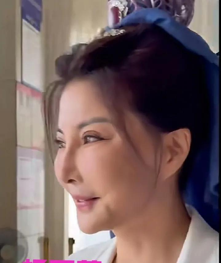 港星杨丽菁的脸只能用惊悚来形容了，她应该是皱纹蛮多的，否则谁会对自己下得了这个狠