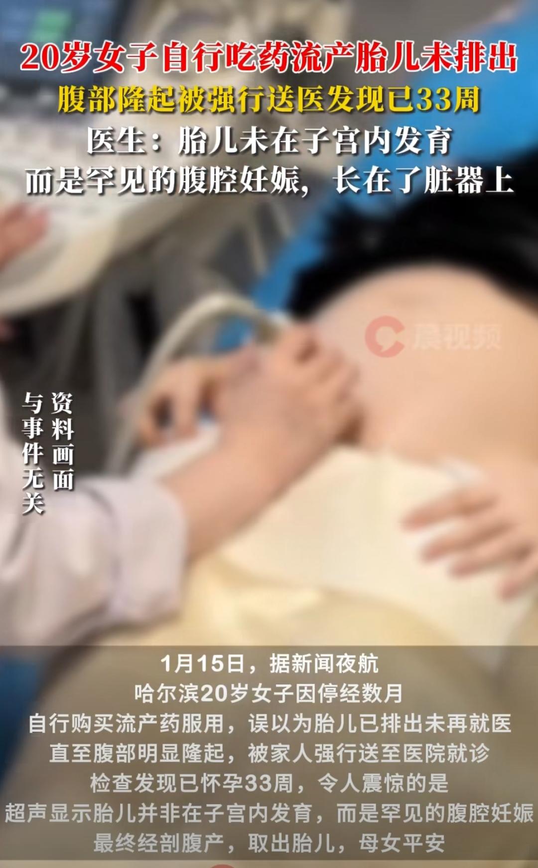 哈尔滨一名20岁的姑娘，因为停经好几个月，自己怀疑是怀孕了，既没敢告诉家人也没去