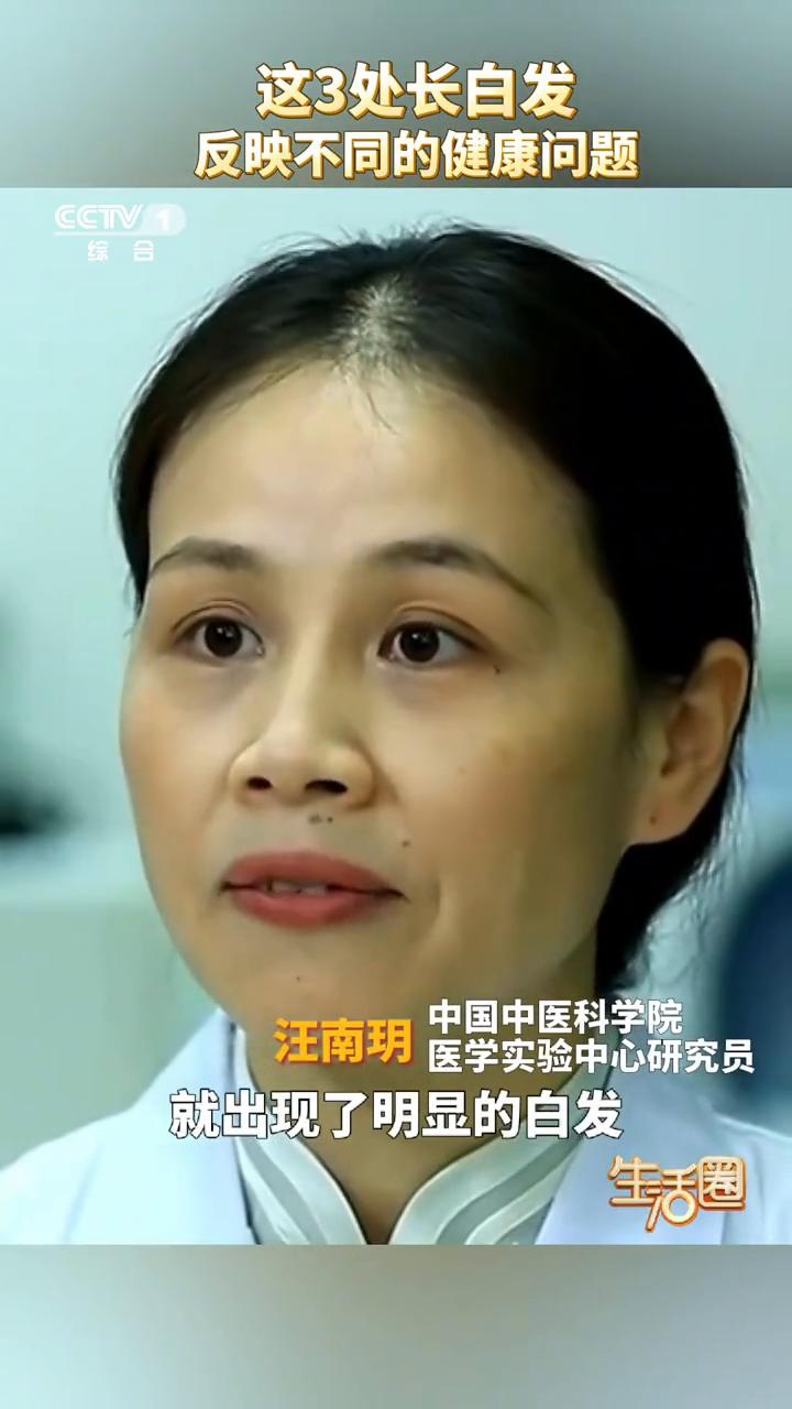 这3处长白发反映不同的健康问题。中国中医科学院医学实验中心研究员汪南玥。女性