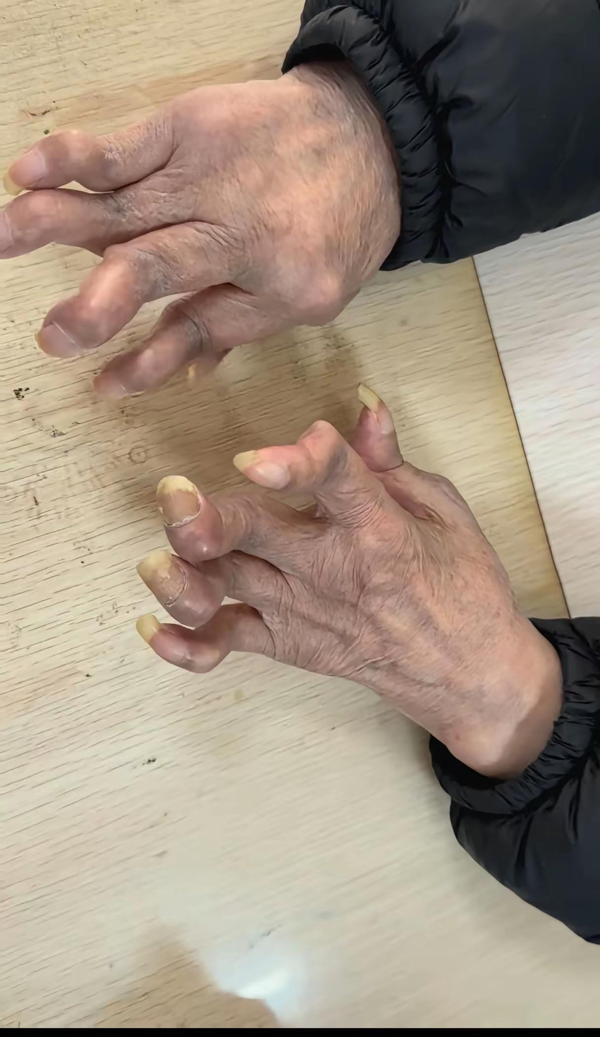 现在科技这么发达为什么这个病治不好呢？