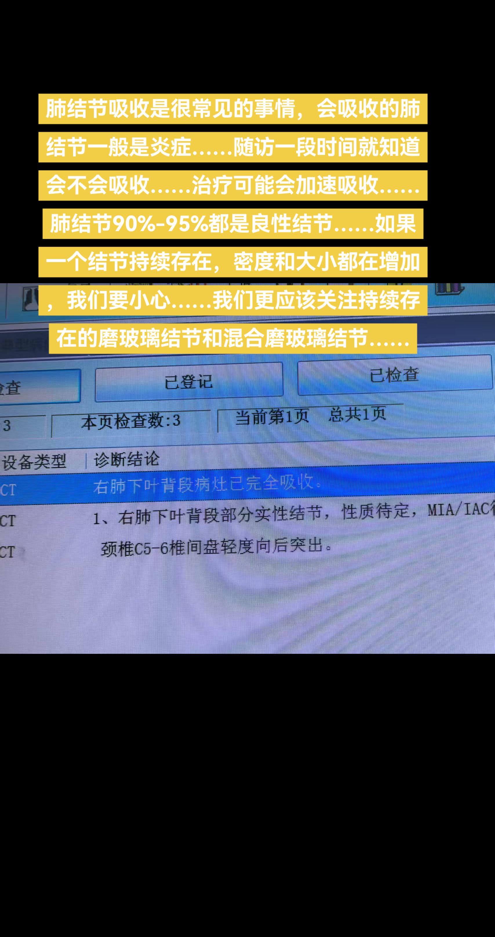 肺结节吸收是很常见的事情，会吸收的肺结节一般是炎症……随访一段时间就知...