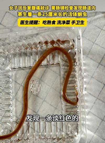 浙江金华，40多岁王女士腹痛，她以为是拉肚子，没在意，结果吃药后还是反复腹痛，只