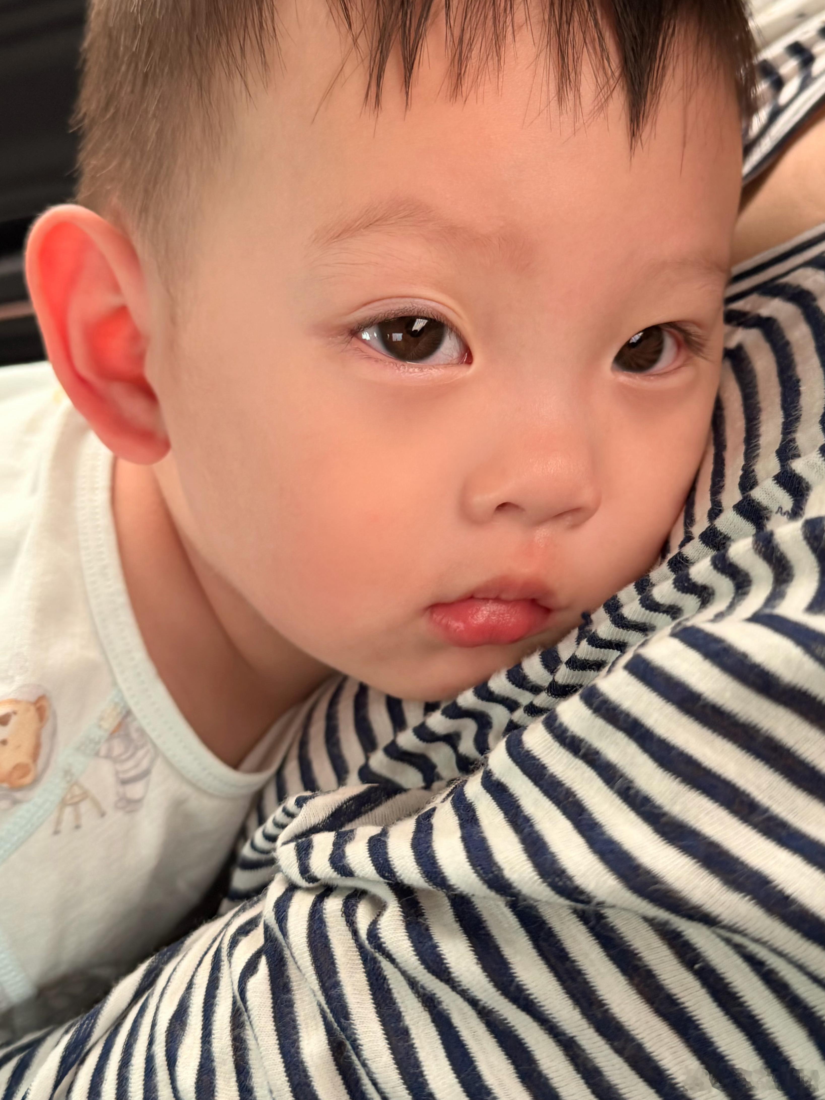 这两天心力交瘁了宝宝发烧感染乙流甲流了烧成双眼皮了反复发烧​​​