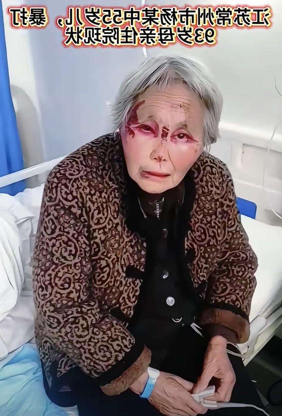 江苏常州的这个老母亲太可怜了，被他儿子揍的满脸开花。93岁了不图享儿女的福，她也