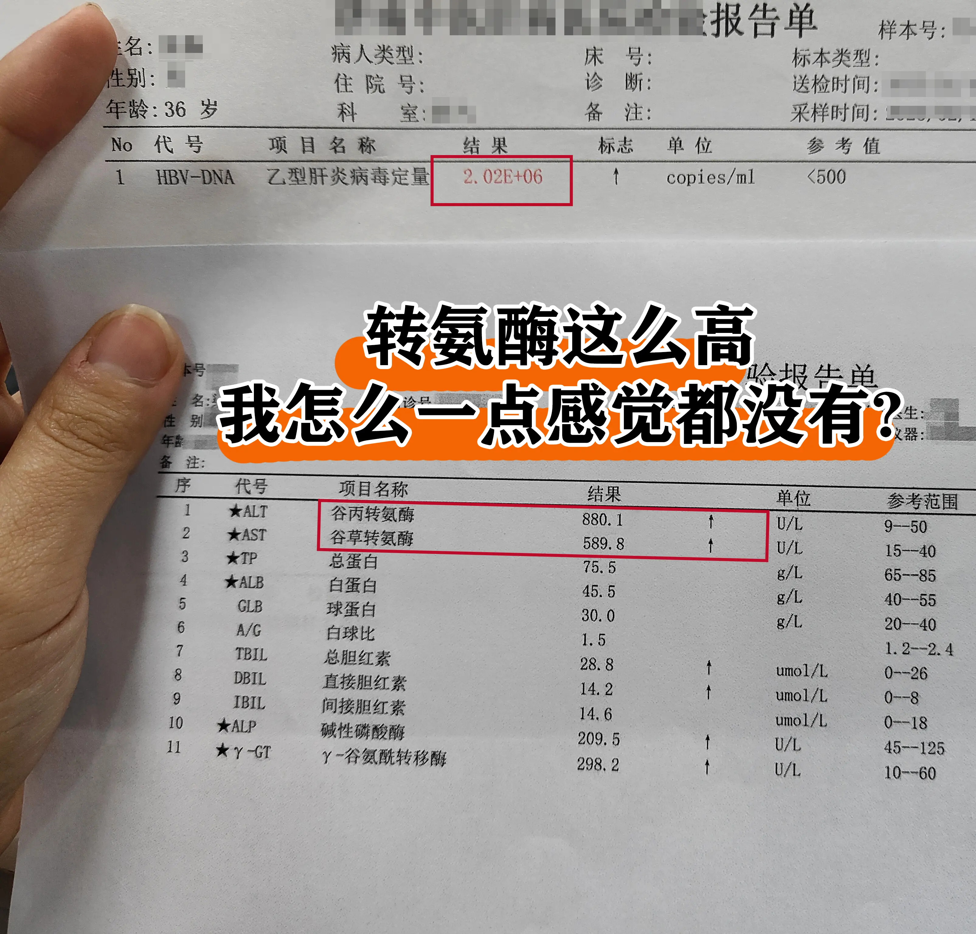 有乙肝不要以为没感觉就没事！。震惊！这位患者6次方的病毒载量，有乙肝还...