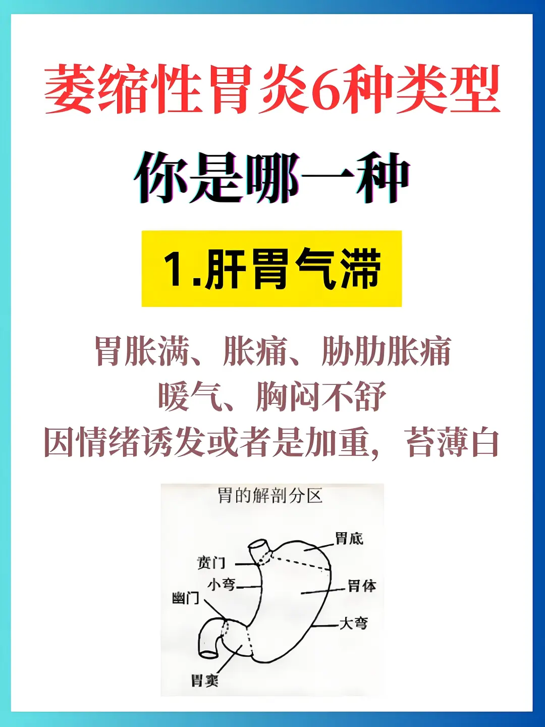 萎缩性胃炎5种类型，你是哪一种？