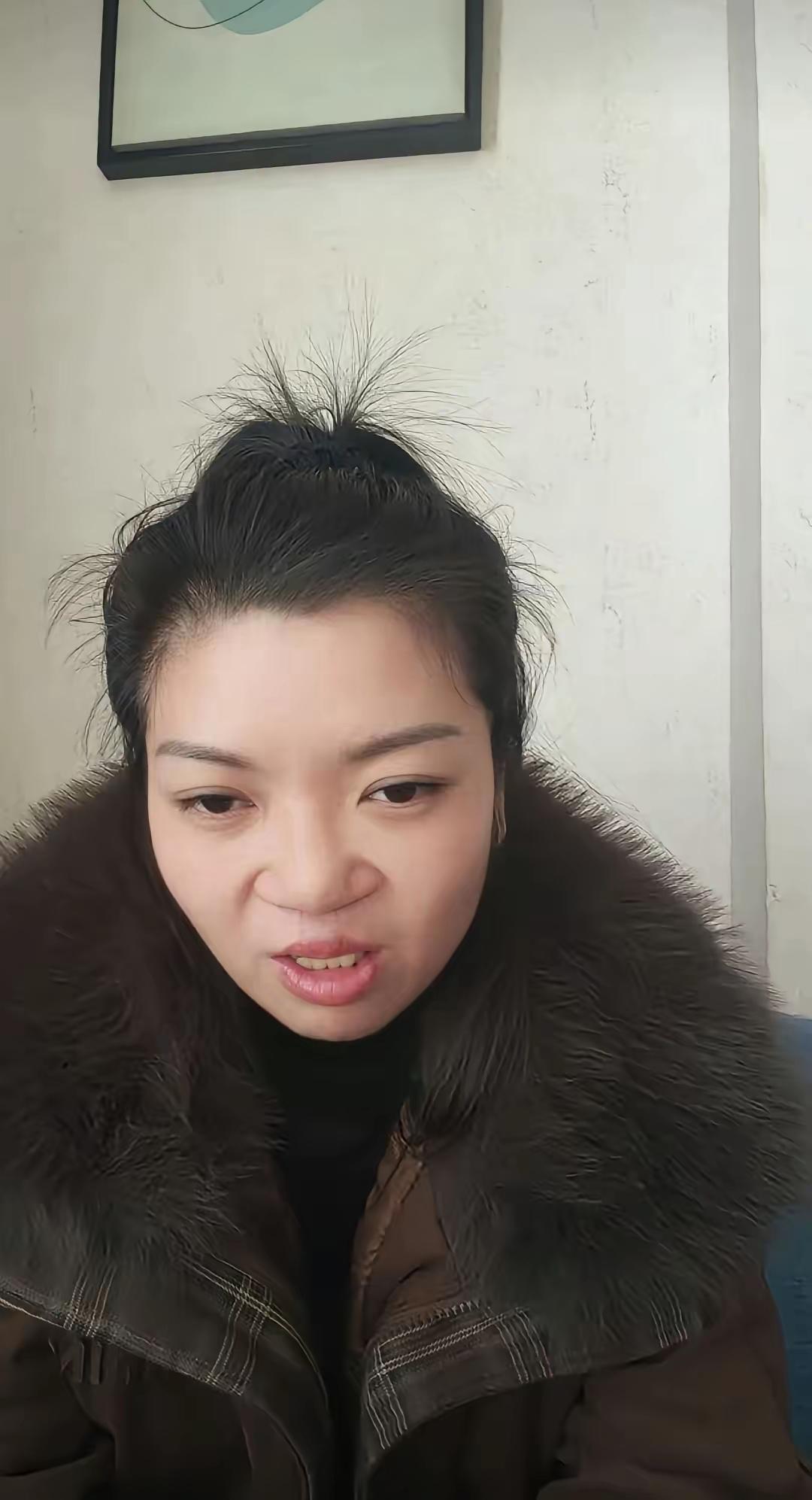 自揭伤疤，这得需要多大的勇气啊！嫣然天使儿童医院面临关闭危机，一女孩主动发视