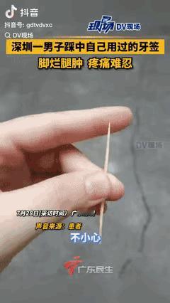 “悲剧还是发生了！”广东一男子不小心踩中了，自己用过的牙签，眼看伤口就一个小洞，
