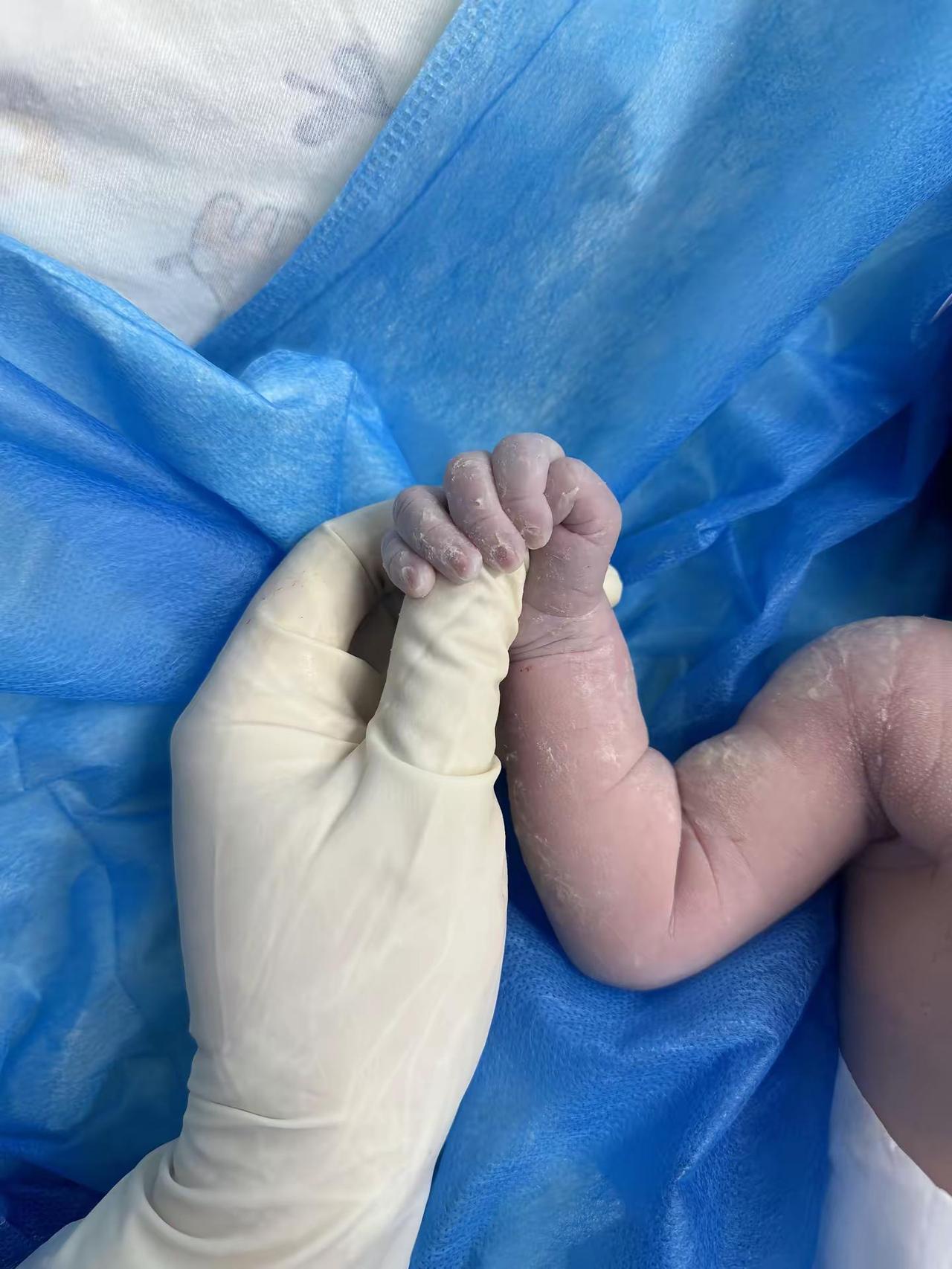 看看这小拳头握的✊🏻恭喜你出生了