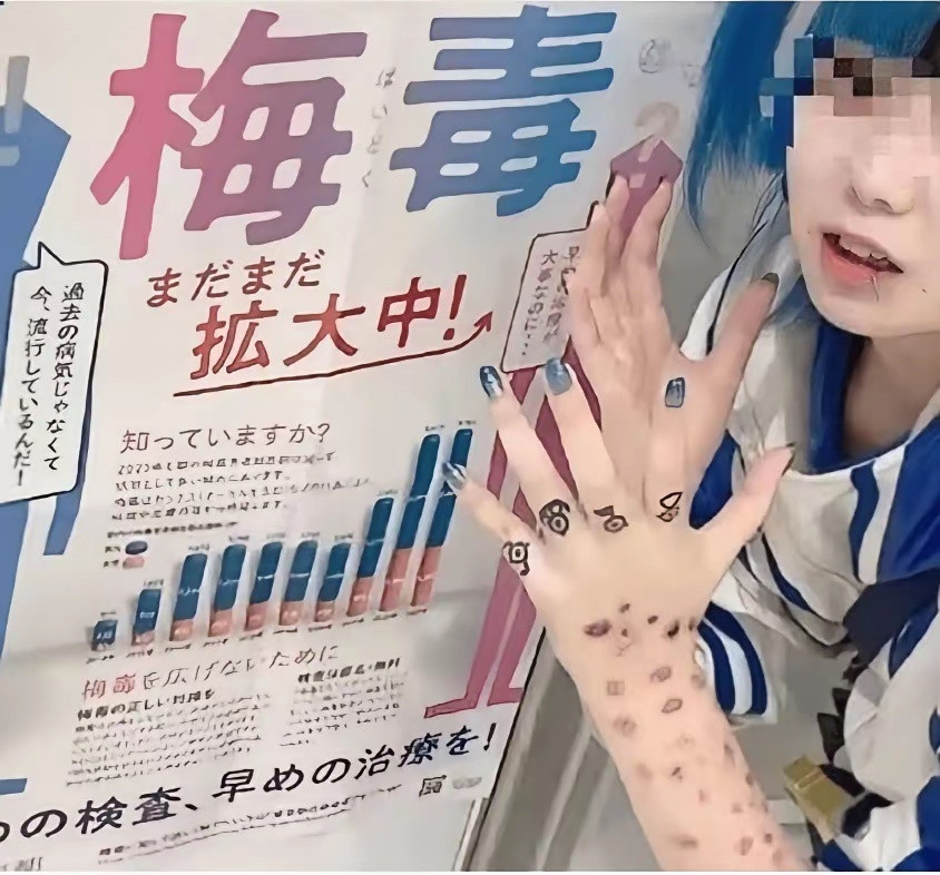 日本年轻人扎堆公开“晒梅毒”，没得病的还专门化妆模仿