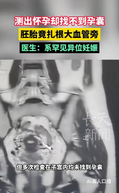 “太离奇了！”广东深圳，一女子验孕棒测出两道杠，满心欢喜去医院做B超，谁知子宫里